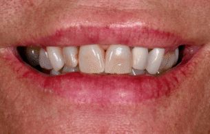 bna-sample