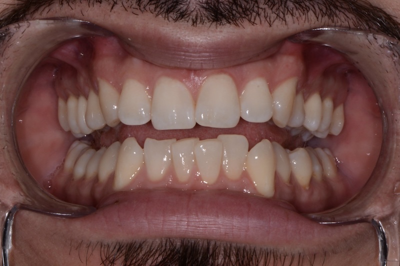 Before
