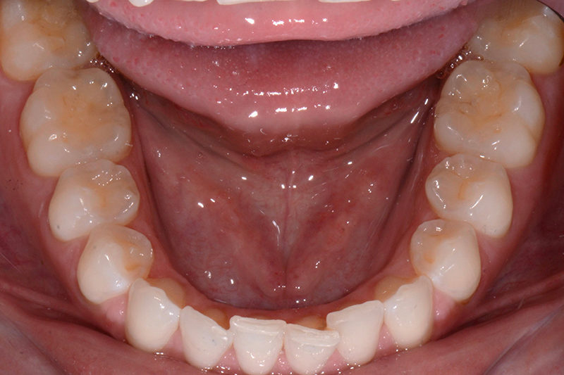 Before